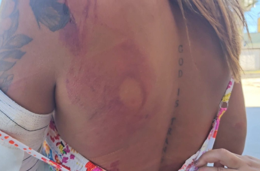  Mulher trans é agredida a pauladas por cinco homens na madrugada deste domingo em Cabo Frio